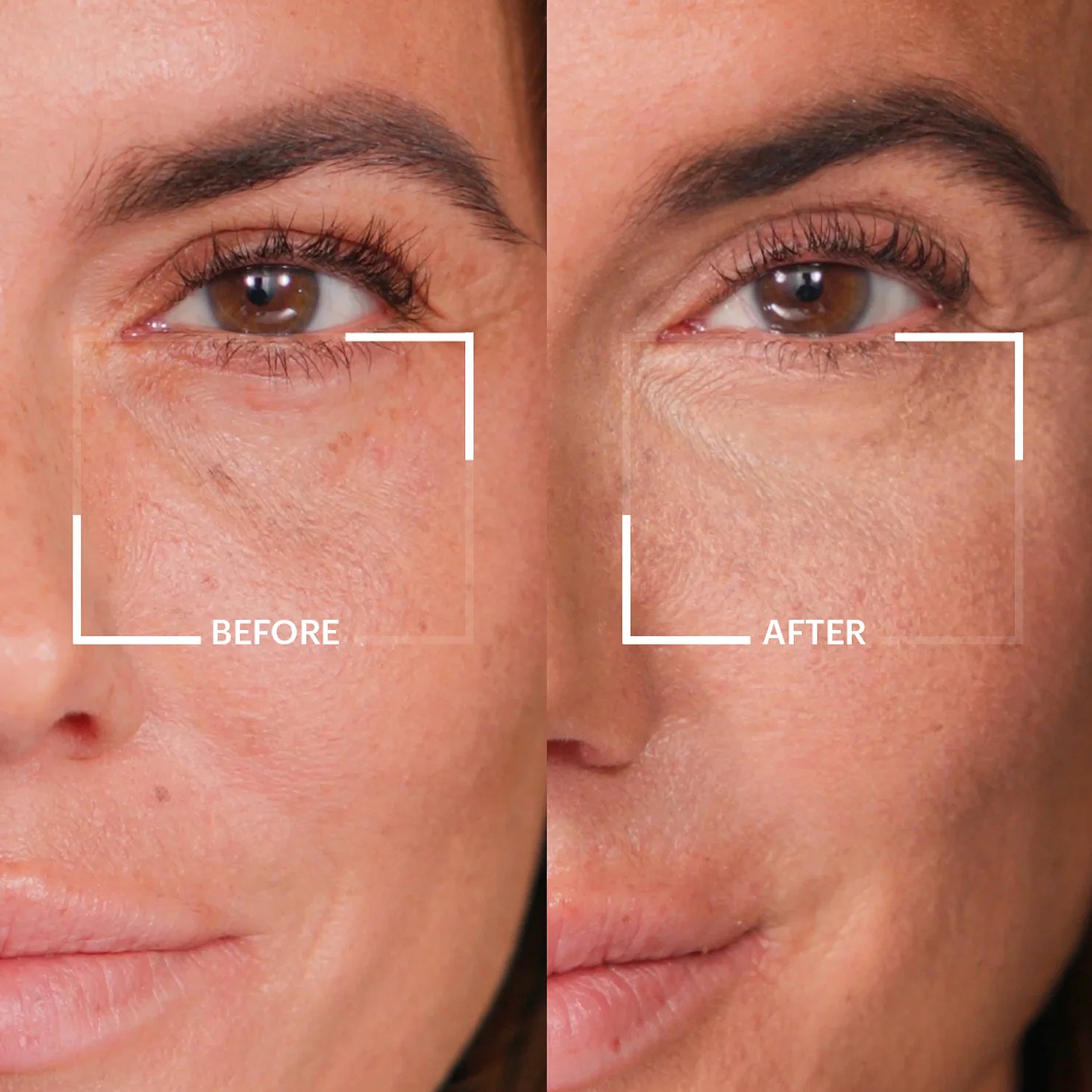 Baby Fresh Eyes Under Eye Brightening Corrector (Light Medium)